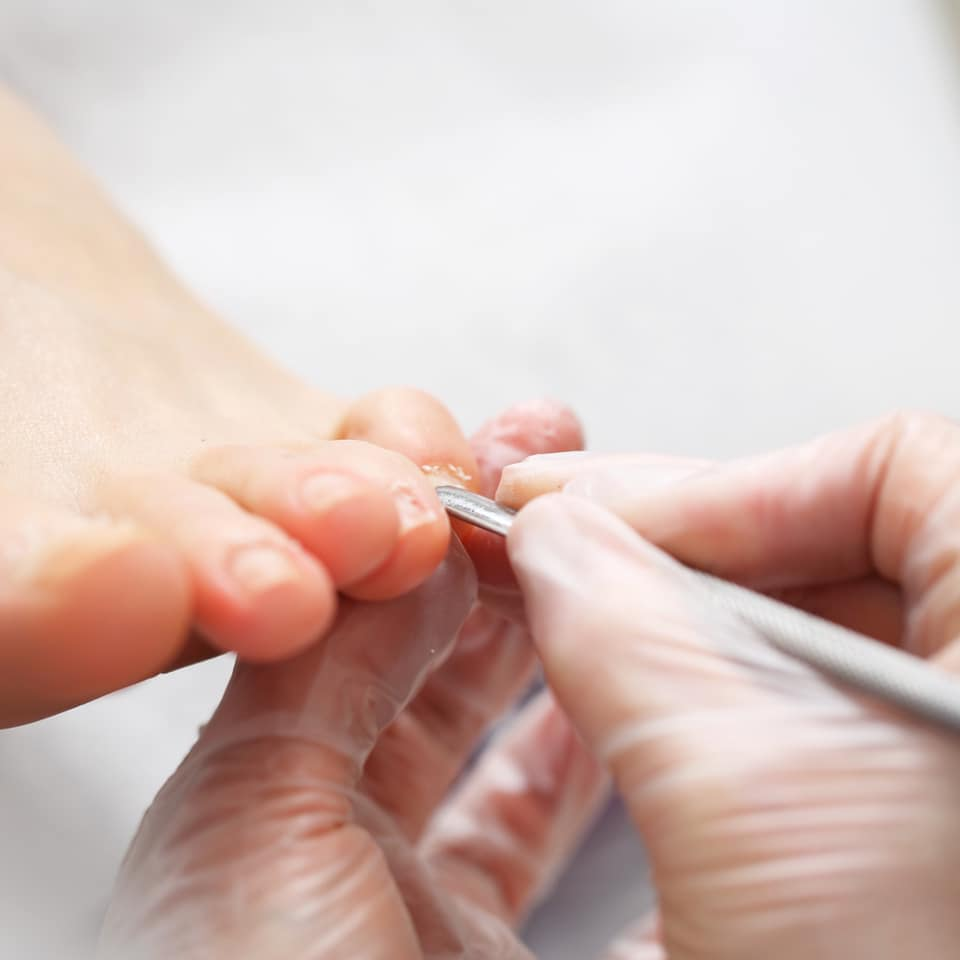 Podiatry care